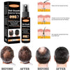 Hair Regrowth Spray