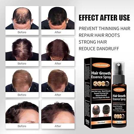 Hair Regrowth Spray